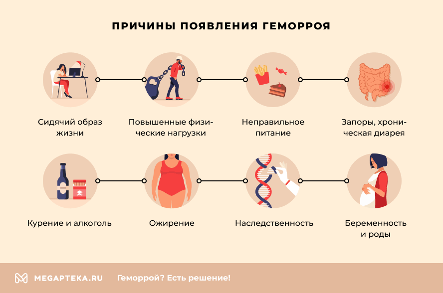 Лучшие свечи от геморроя недорогие и эффективные: какие бывают и какое выбрать
