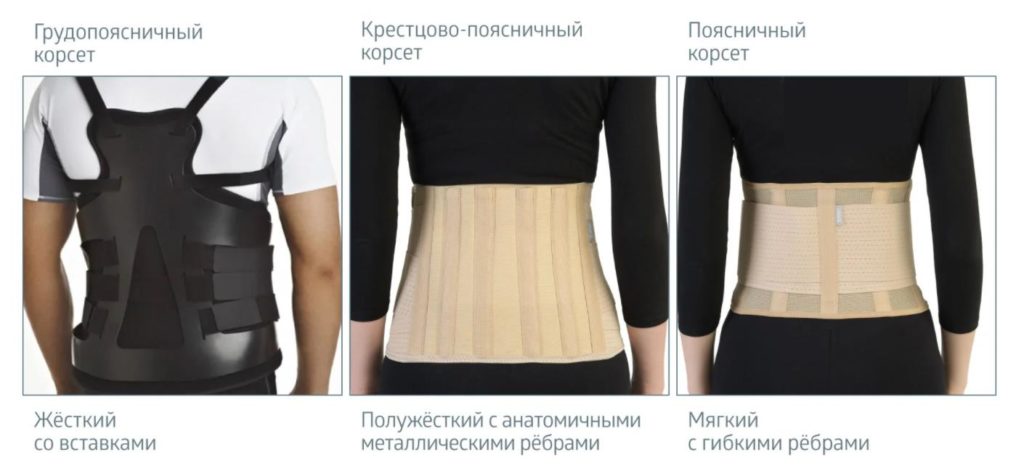 Что нужно знать об ортопедических корсетах